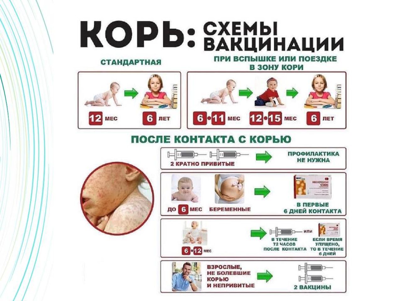 Специфическая профилактика кори. Мкб корь прививка. Корь вакцинация схема.